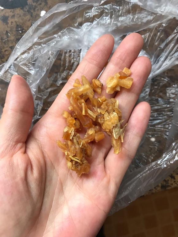 健脾化痰，提高免疫力：西洋参天冬川贝炖鹧鸪